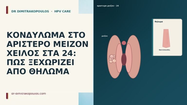 ΚΟΝΔΥΛΩΜΑ ΣΤΟ ΑΡΙΣΤΕΡΟ ΜΕΙΖΟΝ ΧΕΙΛΟΣ ΣΤΑ 24: ΠΩΣ ΞΕΧΩΡΙΖΕΙ ΑΠΟ