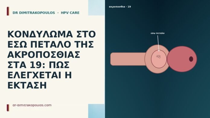 ΚΟΝΔΥΛΩΜΑ ΣΤΟ ΕΣΩ ΠΕΤΑΛΟ ΤΗΣ ΑΚΡΟΠΟΣΘΙΑΣ ΣΤΑ 19: ΠΩΣ ΕΛΕΓΧΕΤΑΙ Η ΕΚΤΑΣΗ ΚΟΝΔΥΛΩΜΑ ΣΤΟ ΕΣΩ ΠΕΤΑΛΟ ΤΗΣ ΑΚΡΟΠΟΣΘΙΑΣ ΣΤΑ 19: ΠΩΣ ΕΛΕΓΧΕΤΑΙ