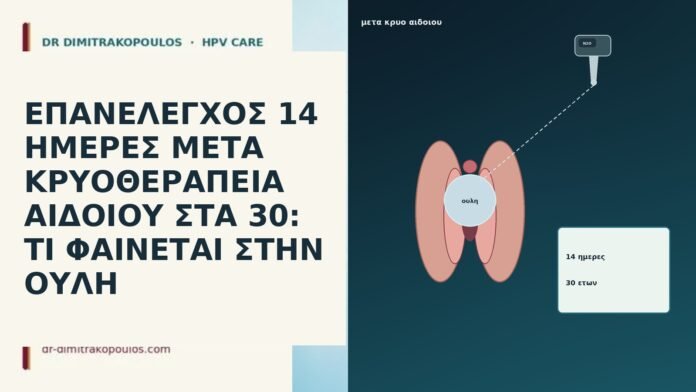 ΕΠΑΝΕΛΕΓΧΟΣ 14 ΗΜΕΡΕΣ ΜΕΤΑ ΚΡΥΟΘΕΡΑΠΕΙΑ ΑΙΔΟΙΟΥ ΣΤΑ 30: ΤΙ ΦΑΙΝΕΤΑΙ ΣΤΗΝ ΟΥΛΗ ΕΠΑΝΕΛΕΓΧΟΣ 14 ΗΜΕΡΕΣ ΜΕΤΑ ΚΡΥΟΘΕΡΑΠΕΙΑ ΑΙΔΟΙΟΥ ΣΤΑ 30: ΤΙ ΦΑΙΝΕΤΑΙ