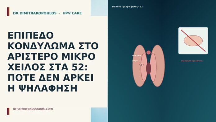 ΕΠΙΠΕΔΟ ΚΟΝΔΥΛΩΜΑ ΣΤΟ ΑΡΙΣΤΕΡΟ ΜΙΚΡΟ ΧΕΙΛΟΣ ΣΤΑ 52: ΠΟΤΕ ΔΕΝ ΑΡΚΕΙ Η ΨΗΛΑΦΗΣΗ ΕΠΙΠΕΔΟ ΚΟΝΔΥΛΩΜΑ ΣΤΟ ΑΡΙΣΤΕΡΟ ΜΙΚΡΟ ΧΕΙΛΟΣ ΣΤΑ 52: ΠΟΤΕ ΔΕΝ