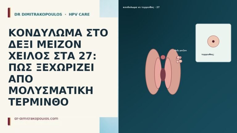 ΚΟΝΔΥΛΩΜΑ ΣΤΟ ΔΕΞΙ ΜΕΙΖΟΝ ΧΕΙΛΟΣ ΣΤΑ 27: ΠΩΣ ΞΕΧΩΡΙΖΕΙ ΑΠΟ