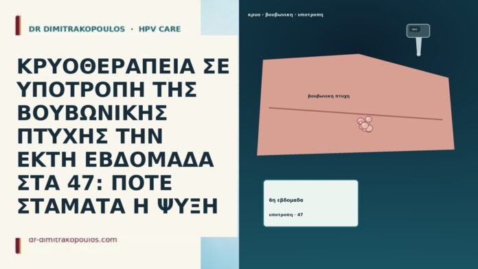 ΚΡΥΟΘΕΡΑΠΕΙΑ ΣΕ ΥΠΟΤΡΟΠΗ ΤΗΣ ΒΟΥΒΩΝΙΚΗΣ ΠΤΥΧΗΣ ΤΗΝ ΕΚΤΗ ΕΒΔΟΜΑΔΑ ΣΤΑ 47: ΠΟΤΕ ΣΤΑΜΑΤΑ Η ΨΥΞΗ ΚΡΥΟΘΕΡΑΠΕΙΑ ΣΕ ΥΠΟΤΡΟΠΗ ΤΗΣ ΒΟΥΒΩΝΙΚΗΣ ΠΤΥΧΗΣ ΤΗΝ ΕΚΤΗ ΕΒΔΟΜΑΔΑ ΣΤΑ