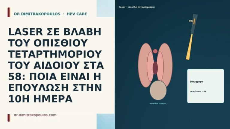 LASER ΣΕ ΒΛΑΒΗ ΤΟΥ ΟΠΙΣΘΙΟΥ ΤΕΤΑΡΤΗΜΟΡΙΟΥ ΤΟΥ ΑΙΔΟΙΟΥ ΣΤΑ 58: