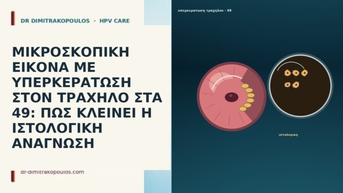 ΜΙΚΡΟΣΚΟΠΙΚΗ ΕΙΚΟΝΑ ΜΕ ΥΠΕΡΚΕΡΑΤΩΣΗ ΣΤΟΝ ΤΡΑΧΗΛΟ ΣΤΑ 49: ΠΩΣ ΚΛΕΙΝΕΙ Η ΙΣΤΟΛΟΓΙΚΗ ΑΝΑΓΝΩΣΗ ΜΙΚΡΟΣΚΟΠΙΚΗ ΕΙΚΟΝΑ ΜΕ ΥΠΕΡΚΕΡΑΤΩΣΗ ΣΤΟΝ ΤΡΑΧΗΛΟ ΣΤΑ 49: ΠΩΣ ΚΛΕΙΝΕΙ