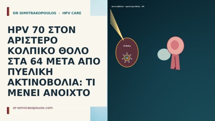 HPV 70 ΣΤΟΝ ΑΡΙΣΤΕΡΟ ΚΟΛΠΙΚΟ ΘΟΛΟ ΣΤΑ 64 ΜΕΤΑ ΑΠΟ ΠΥΕΛΙΚΗ ΑΚΤΙΝΟΒΟΛΙΑ: ΤΙ ΜΕΝΕΙ ΑΝΟΙΧΤΟ HPV 70 ΣΤΟΝ ΑΡΙΣΤΕΡΟ ΚΟΛΠΙΚΟ ΘΟΛΟ ΣΤΑ 64 ΜΕΤΑ ΑΠΟ