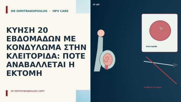 ΚΥΗΣΗ 20 ΕΒΔΟΜΑΔΩΝ ΜΕ ΚΟΝΔΥΛΩΜΑ ΣΤΗΝ ΚΛΕΙΤΟΡΙΔΑ: ΠΟΤΕ ΑΝΑΒΑΛΛΕΤΑΙ Η