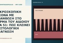 ΜΙΚΡΟΣΚΟΠΙΚΗ ΕΙΚΟΝΑ ΜΕ ΑΚΑΝΘΩΣΗ ΣΤΟ ΔΕΡΜΑ ΤΟΥ ΑΙΔΟΙΟΥ ΣΤΑ 51: