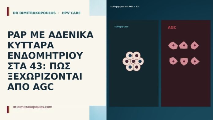 PAP ΜΕ ΑΔΕΝΙΚΑ ΚΥΤΤΑΡΑ ΕΝΔΟΜΗΤΡΙΟΥ ΣΤΑ 43: ΠΩΣ ΞΕΧΩΡΙΖΟΝΤΑΙ ΑΠΟ AGC PAP ΜΕ ΑΔΕΝΙΚΑ ΚΥΤΤΑΡΑ ΕΝΔΟΜΗΤΡΙΟΥ ΣΤΑ 43: ΠΩΣ ΞΕΧΩΡΙΖΟΝΤΑΙ ΑΠΟ