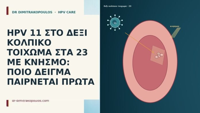 HPV 11 ΣΤΟ ΔΕΞΙ ΚΟΛΠΙΚΟ ΤΟΙΧΩΜΑ ΣΤΑ 23 ΜΕ ΚΝΗΣΜΟ: ΠΟΙΟ ΔΕΙΓΜΑ ΠΑΙΡΝΕΤΑΙ ΠΡΩΤΑ HPV 11 ΣΤΟ ΔΕΞΙ ΚΟΛΠΙΚΟ ΤΟΙΧΩΜΑ ΣΤΑ 23 ΜΕ ΚΝΗΣΜΟ: