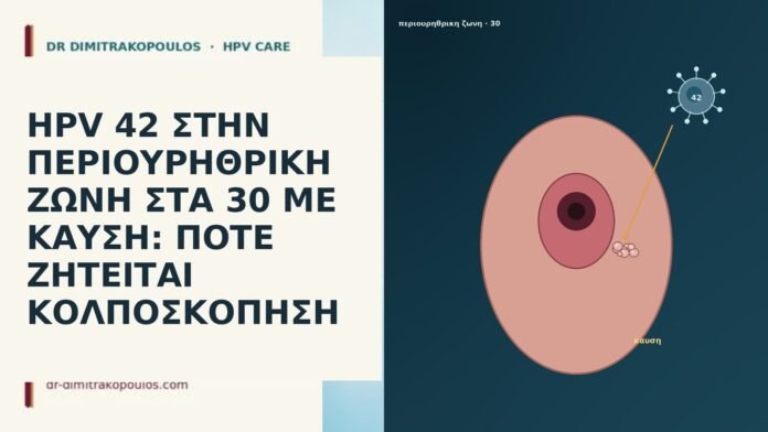 HPV 42 ΣΤΗΝ ΠΕΡΙΟΥΡΗΘΡΙΚΗ ΖΩΝΗ ΣΤΑ 30 ΜΕ ΚΑΥΣΗ: ΠΟΤΕ ΖΗΤΕΙΤΑΙ ΚΟΛΠΟΣΚΟΠΗΣΗ HPV 42 ΣΤΗΝ ΠΕΡΙΟΥΡΗΘΡΙΚΗ ΖΩΝΗ ΣΤΑ 30 ΜΕ ΚΑΥΣΗ: ΠΟΤΕ