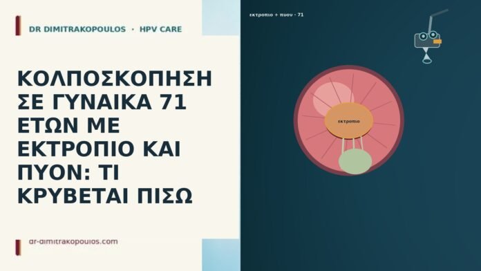 ΚΟΛΠΟΣΚΟΠΗΣΗ ΣΕ ΓΥΝΑΙΚΑ 71 ΕΤΩΝ ΜΕ ΕΚΤΡΟΠΙΟ ΚΑΙ ΠΥΟΝ: ΤΙ ΚΡΥΒΕΤΑΙ ΠΙΣΩ ΚΟΛΠΟΣΚΟΠΗΣΗ ΣΕ ΓΥΝΑΙΚΑ 71 ΕΤΩΝ ΜΕ ΕΚΤΡΟΠΙΟ ΚΑΙ ΠΥΟΝ: ΤΙ
