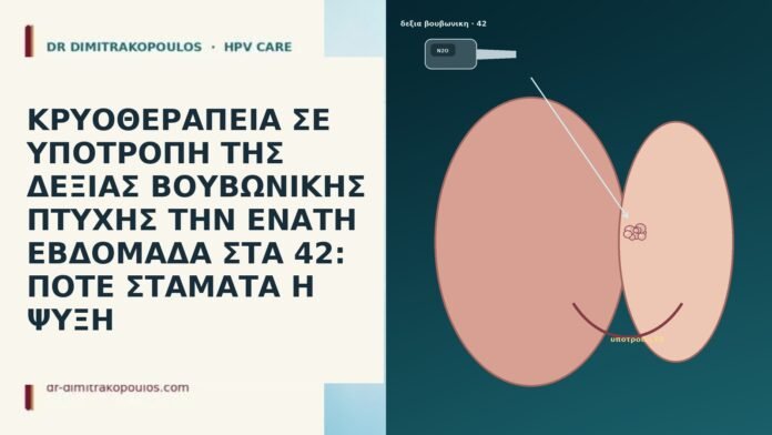 ΚΡΥΟΘΕΡΑΠΕΙΑ ΣΕ ΥΠΟΤΡΟΠΗ ΤΗΣ ΔΕΞΙΑΣ ΒΟΥΒΩΝΙΚΗΣ ΠΤΥΧΗΣ ΤΗΝ ΕΝΑΤΗ ΕΒΔΟΜΑΔΑ