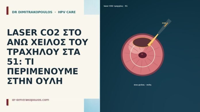 LASER CO2 ΣΤΟ ΑΝΩ ΧΕΙΛΟΣ ΤΟΥ ΤΡΑΧΗΛΟΥ ΣΤΑ 51: ΤΙ ΠΕΡΙΜΕΝΟΥΜΕ ΣΤΗΝ ΟΥΛΗ LASER CO2 ΣΤΟ ΑΝΩ ΧΕΙΛΟΣ ΤΟΥ ΤΡΑΧΗΛΟΥ ΣΤΑ 51: ΤΙ