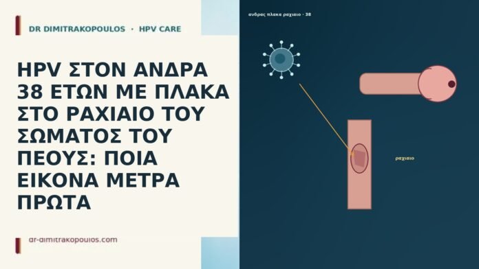 HPV ΣΤΟΝ ΑΝΔΡΑ 38 ΕΤΩΝ ΜΕ ΠΛΑΚΑ ΣΤΟ ΡΑΧΙΑΙΟ ΤΟΥ