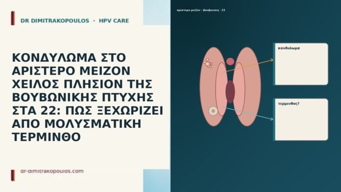 ΚΟΝΔΥΛΩΜΑ ΣΤΟ ΑΡΙΣΤΕΡΟ ΜΕΙΖΟΝ ΧΕΙΛΟΣ ΠΛΗΣΙΟΝ ΤΗΣ ΒΟΥΒΩΝΙΚΗΣ ΠΤΥΧΗΣ ΣΤΑ