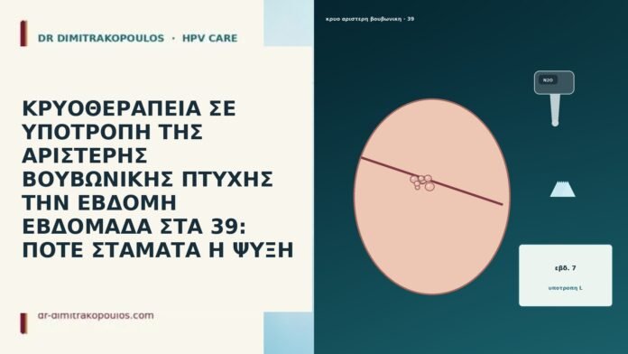 ΚΡΥΟΘΕΡΑΠΕΙΑ ΣΕ ΥΠΟΤΡΟΠΗ ΤΗΣ ΑΡΙΣΤΕΡΗΣ ΒΟΥΒΩΝΙΚΗΣ ΠΤΥΧΗΣ ΤΗΝ ΕΒΔΟΜΗ ΕΒΔΟΜΑΔΑ
