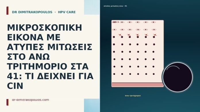 ΜΙΚΡΟΣΚΟΠΙΚΗ ΕΙΚΟΝΑ ΜΕ ΑΤΥΠΕΣ ΜΙΤΩΣΕΙΣ ΣΤΟ ΑΝΩ ΤΡΙΤΗΜΟΡΙΟ ΣΤΑ 41: ΤΙ ΔΕΙΧΝΕΙ ΓΙΑ CIN ΜΙΚΡΟΣΚΟΠΙΚΗ ΕΙΚΟΝΑ ΜΕ ΑΤΥΠΕΣ ΜΙΤΩΣΕΙΣ ΣΤΟ ΑΝΩ ΤΡΙΤΗΜΟΡΙΟ ΣΤΑ 41: