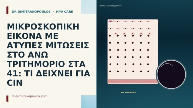 ΜΙΚΡΟΣΚΟΠΙΚΗ ΕΙΚΟΝΑ ΜΕ ΑΤΥΠΕΣ ΜΙΤΩΣΕΙΣ ΣΤΟ ΑΝΩ ΤΡΙΤΗΜΟΡΙΟ ΣΤΑ 41: