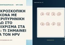 ΜΙΚΡΟΣΚΟΠΙΚΗ ΕΙΚΟΝΑ ΜΕ ΠΕΡΙΠΥΡΗΝΙΚΗ ΑΛΩ ΣΤΟ ΕΠΙΧΡΙΣΜΑ ΣΤΑ 32: ΤΙ
