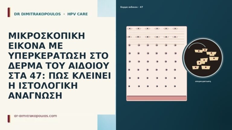 ΜΙΚΡΟΣΚΟΠΙΚΗ ΕΙΚΟΝΑ ΜΕ ΥΠΕΡΚΕΡΑΤΩΣΗ ΣΤΟ ΔΕΡΜΑ ΤΟΥ ΑΙΔΟΙΟΥ ΣΤΑ 47: