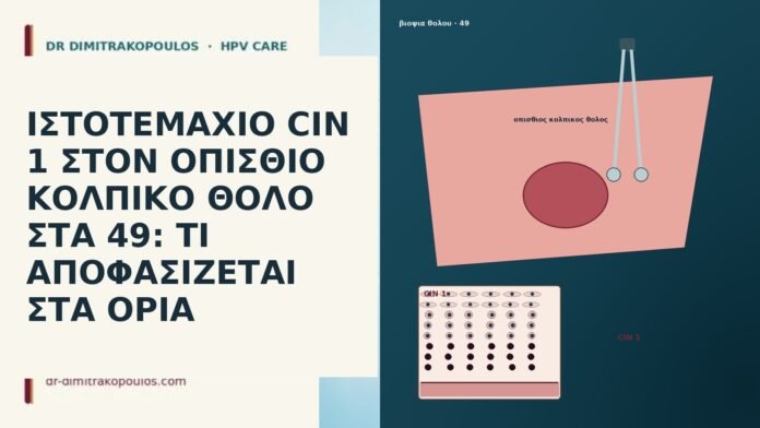 ΙΣΤΟΤΕΜΑΧΙΟ CIN 1 ΣΤΟΝ ΟΠΙΣΘΙΟ ΚΟΛΠΙΚΟ ΘΟΛΟ ΣΤΑ 49: ΤΙ ΑΠΟΦΑΣΙΖΕΤΑΙ ΣΤΑ ΟΡΙΑ ΙΣΤΟΤΕΜΑΧΙΟ CIN 1 ΣΤΟΝ ΟΠΙΣΘΙΟ ΚΟΛΠΙΚΟ ΘΟΛΟ ΣΤΑ 49: ΤΙ