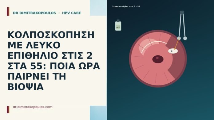 ΚΟΛΠΟΣΚΟΠΗΣΗ ΜΕ ΛΕΥΚΟ ΕΠΙΘΗΛΙΟ ΣΤΙΣ 2 ΣΤΑ 55: ΠΟΙΑ ΩΡΑ ΠΑΙΡΝΕΙ ΤΗ ΒΙΟΨΙΑ ΚΟΛΠΟΣΚΟΠΗΣΗ ΜΕ ΛΕΥΚΟ ΕΠΙΘΗΛΙΟ ΣΤΙΣ 2 ΣΤΑ 55: ΠΟΙΑ ΩΡΑ