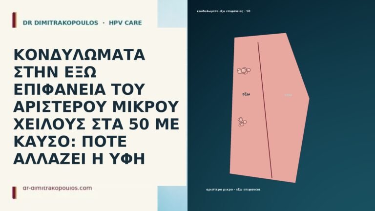 ΚΟΝΔΥΛΩΜΑΤΑ ΣΤΗΝ ΕΞΩ ΕΠΙΦΑΝΕΙΑ ΤΟΥ ΑΡΙΣΤΕΡΟΥ ΜΙΚΡΟΥ ΧΕΙΛΟΥΣ ΣΤΑ 50