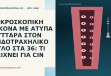 ΜΙΚΡΟΣΚΟΠΙΚΗ ΕΙΚΟΝΑ ΜΕ ΑΤΥΠΑ ΚΥΤΤΑΡΑ ΣΤΟΝ ΕΝΔΟΤΡΑΧΗΛΙΚΟ ΑΥΛΟ ΣΤΑ 36: