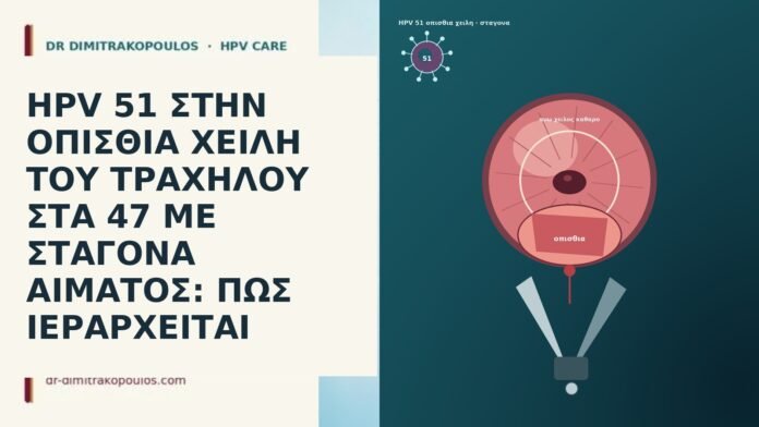 HPV 51 ΣΤΗΝ ΟΠΙΣΘΙΑ ΧΕΙΛΗ ΤΟΥ ΤΡΑΧΗΛΟΥ ΣΤΑ 47 ΜΕ ΣΤΑΓΟΝΑ ΑΙΜΑΤΟΣ: ΠΩΣ ΙΕΡΑΡΧΕΙΤΑΙ HPV 51 ΣΤΗΝ ΟΠΙΣΘΙΑ ΧΕΙΛΗ ΤΟΥ ΤΡΑΧΗΛΟΥ ΣΤΑ 47 ΜΕ