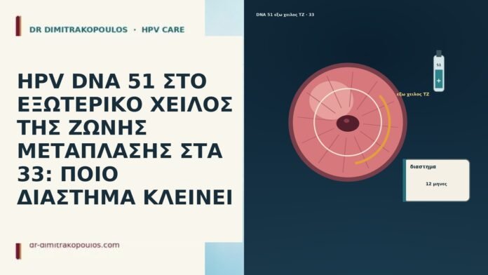 HPV DNA 51 ΣΤΟ ΕΞΩΤΕΡΙΚΟ ΧΕΙΛΟΣ ΤΗΣ ΖΩΝΗΣ ΜΕΤΑΠΛΑΣΗΣ ΣΤΑ 33: ΠΟΙΟ ΔΙΑΣΤΗΜΑ ΚΛΕΙΝΕΙ HPV DNA 51 ΣΤΟ ΕΞΩΤΕΡΙΚΟ ΧΕΙΛΟΣ ΤΗΣ ΖΩΝΗΣ ΜΕΤΑΠΛΑΣΗΣ ΣΤΑ