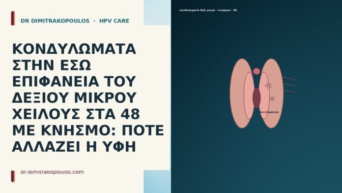 ΚΟΝΔΥΛΩΜΑΤΑ ΣΤΗΝ ΕΣΩ ΕΠΙΦΑΝΕΙΑ ΤΟΥ ΔΕΞΙΟΥ ΜΙΚΡΟΥ ΧΕΙΛΟΥΣ ΣΤΑ 48