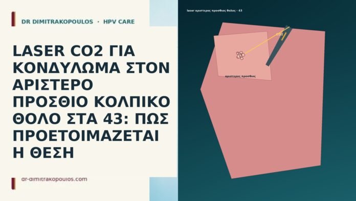 LASER CO2 ΓΙΑ ΚΟΝΔΥΛΩΜΑ ΣΤΟΝ ΑΡΙΣΤΕΡΟ ΠΡΟΣΘΙΟ ΚΟΛΠΙΚΟ ΘΟΛΟ ΣΤΑ 43: ΠΩΣ ΠΡΟΕΤΟΙΜΑΖΕΤΑΙ Η ΘΕΣΗ LASER CO2 ΓΙΑ ΚΟΝΔΥΛΩΜΑ ΣΤΟΝ ΑΡΙΣΤΕΡΟ ΠΡΟΣΘΙΟ ΚΟΛΠΙΚΟ ΘΟΛΟ ΣΤΑ