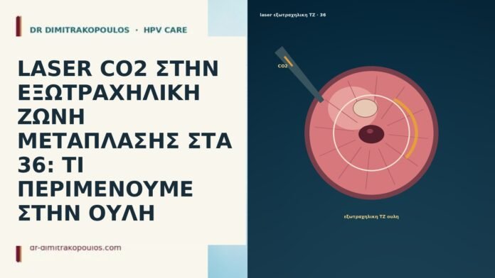 LASER CO2 ΣΤΗΝ ΕΞΩΤΡΑΧΗΛΙΚΗ ΖΩΝΗ ΜΕΤΑΠΛΑΣΗΣ ΣΤΑ 36: ΤΙ ΠΕΡΙΜΕΝΟΥΜΕ ΣΤΗΝ ΟΥΛΗ LASER CO2 ΣΤΗΝ ΕΞΩΤΡΑΧΗΛΙΚΗ ΖΩΝΗ ΜΕΤΑΠΛΑΣΗΣ ΣΤΑ 36: ΤΙ ΠΕΡΙΜΕΝΟΥΜΕ