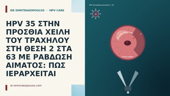 HPV 35 ΣΤΗΝ ΠΡΟΣΘΙΑ ΧΕΙΛΗ ΤΟΥ ΤΡΑΧΗΛΟΥ ΣΤΗ ΘΕΣΗ 2 ΣΤΑ 63 ΜΕ ΡΑΒΔΩΣΗ ΑΙΜΑΤΟΣ: ΠΩΣ ΙΕΡΑΡΧΕΙΤΑΙ HPV 35 ΣΤΗΝ ΠΡΟΣΘΙΑ ΧΕΙΛΗ ΤΟΥ ΤΡΑΧΗΛΟΥ ΣΤΗ ΘΕΣΗ 2