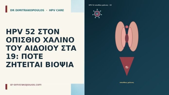 HPV 52 ΣΤΟΝ ΟΠΙΣΘΙΟ ΧΑΛΙΝΟ ΤΟΥ ΑΙΔΟΙΟΥ ΣΤΑ 19: ΠΟΤΕ ΖΗΤΕΙΤΑΙ ΒΙΟΨΙΑ HPV 52 ΣΤΟΝ ΟΠΙΣΘΙΟ ΧΑΛΙΝΟ ΤΟΥ ΑΙΔΟΙΟΥ ΣΤΑ 19: ΠΟΤΕ