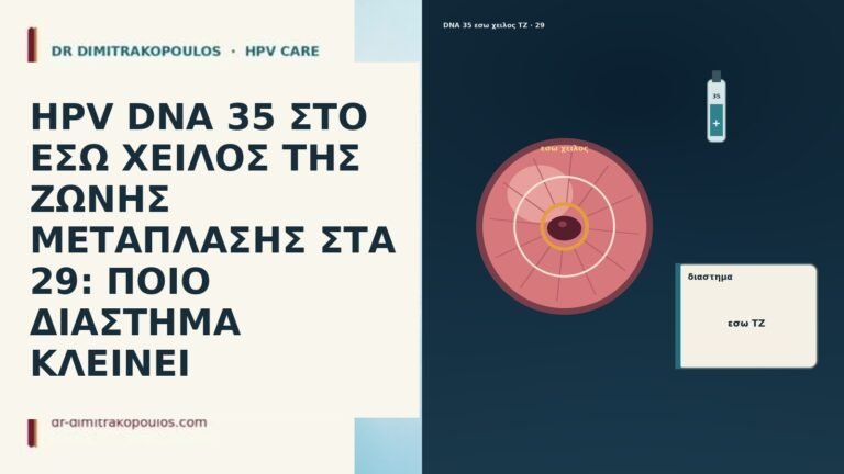 HPV DNA 35 ΣΤΟ ΕΣΩ ΧΕΙΛΟΣ ΤΗΣ ΖΩΝΗΣ ΜΕΤΑΠΛΑΣΗΣ ΣΤΑ