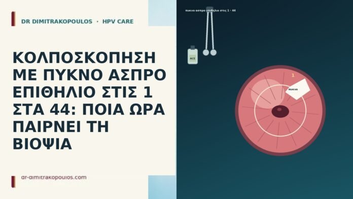 ΚΟΛΠΟΣΚΟΠΗΣΗ ΜΕ ΠΥΚΝΟ ΑΣΠΡΟ ΕΠΙΘΗΛΙΟ ΣΤΙΣ 1 ΣΤΑ 44: ΠΟΙΑ ΩΡΑ ΠΑΙΡΝΕΙ ΤΗ ΒΙΟΨΙΑ ΚΟΛΠΟΣΚΟΠΗΣΗ ΜΕ ΠΥΚΝΟ ΑΣΠΡΟ ΕΠΙΘΗΛΙΟ ΣΤΙΣ 1 ΣΤΑ 44: ΠΟΙΑ
