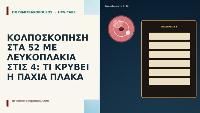 ΚΟΛΠΟΣΚΟΠΗΣΗ ΣΤΑ 52 ΜΕ ΛΕΥΚΟΠΛΑΚΙΑ ΣΤΙΣ 4: ΤΙ ΚΡΥΒΕΙ Η ΠΑΧΙΑ ΠΛΑΚΑ ΚΟΛΠΟΣΚΟΠΗΣΗ ΣΤΑ 52 ΜΕ ΛΕΥΚΟΠΛΑΚΙΑ ΣΤΙΣ 4: ΤΙ ΚΡΥΒΕΙ Η