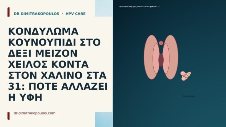 ΚΟΝΔΥΛΩΜΑ ΚΟΥΝΟΥΠΙΔΙ ΣΤΟ ΔΕΞΙ ΜΕΙΖΟΝ ΧΕΙΛΟΣ ΚΟΝΤΑ ΣΤΟΝ ΧΑΛΙΝΟ ΣΤΑ