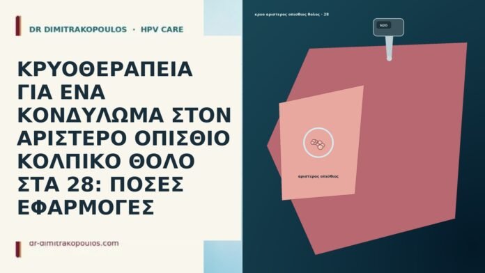 ΚΡΥΟΘΕΡΑΠΕΙΑ ΓΙΑ ΕΝΑ ΚΟΝΔΥΛΩΜΑ ΣΤΟΝ ΑΡΙΣΤΕΡΟ ΟΠΙΣΘΙΟ ΚΟΛΠΙΚΟ ΘΟΛΟ ΣΤΑ