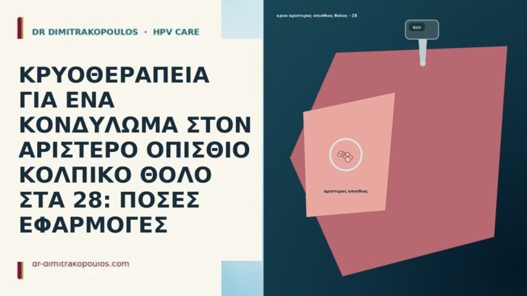 ΚΡΥΟΘΕΡΑΠΕΙΑ ΓΙΑ ΕΝΑ ΚΟΝΔΥΛΩΜΑ ΣΤΟΝ ΑΡΙΣΤΕΡΟ ΟΠΙΣΘΙΟ ΚΟΛΠΙΚΟ ΘΟΛΟ ΣΤΑ