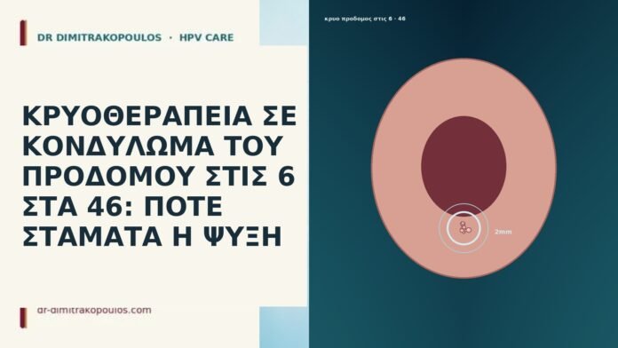 ΚΡΥΟΘΕΡΑΠΕΙΑ ΣΕ ΚΟΝΔΥΛΩΜΑ ΤΟΥ ΠΡΟΔΟΜΟΥ ΣΤΙΣ 6 ΣΤΑ 46: ΠΟΤΕ