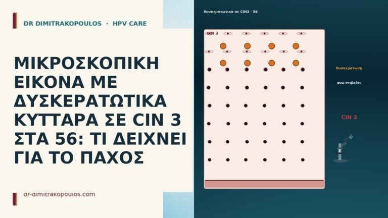 ΜΙΚΡΟΣΚΟΠΙΚΗ ΕΙΚΟΝΑ ΜΕ ΔΥΣΚΕΡΑΤΩΤΙΚΑ ΚΥΤΤΑΡΑ ΣΕ CIN 3 ΣΤΑ 56: