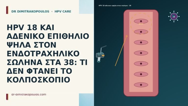HPV 18 ΚΑΙ ΑΔΕΝΙΚΟ ΕΠΙΘΗΛΙΟ ΨΗΛΑ ΣΤΟΝ ΕΝΔΟΤΡΑΧΗΛΙΚΟ ΣΩΛΗΝΑ ΣΤΑ