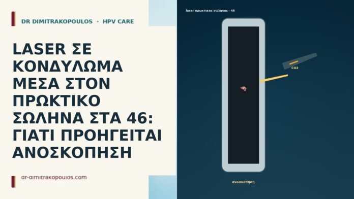 LASER ΣΕ ΚΟΝΔΥΛΩΜΑ ΜΕΣΑ ΣΤΟΝ ΠΡΩΚΤΙΚΟ ΣΩΛΗΝΑ ΣΤΑ 46: ΓΙΑΤΙ ΠΡΟΗΓΕΙΤΑΙ ΑΝΟΣΚΟΠΗΣΗ LASER ΣΕ ΚΟΝΔΥΛΩΜΑ ΜΕΣΑ ΣΤΟΝ ΠΡΩΚΤΙΚΟ ΣΩΛΗΝΑ ΣΤΑ 46: ΓΙΑΤΙ