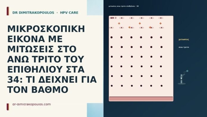 ΜΙΚΡΟΣΚΟΠΙΚΗ ΕΙΚΟΝΑ ΜΕ ΜΙΤΩΣΕΙΣ ΣΤΟ ΑΝΩ ΤΡΙΤΟ ΤΟΥ ΕΠΙΘΗΛΙΟΥ ΣΤΑ