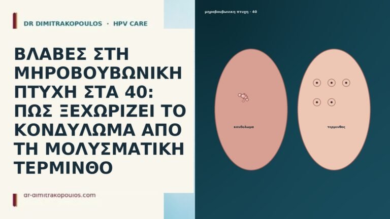 ΒΛΑΒΕΣ ΣΤΗ ΜΗΡΟΒΟΥΒΩΝΙΚΗ ΠΤΥΧΗ ΣΤΑ 40: ΠΩΣ ΞΕΧΩΡΙΖΕΙ ΤΟ ΚΟΝΔΥΛΩΜΑ