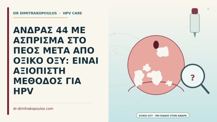 οξικό οξύ στο πέος