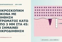 μικροδιήθηση τραχήλου
