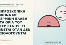 θερμική βλάβη στα όρια